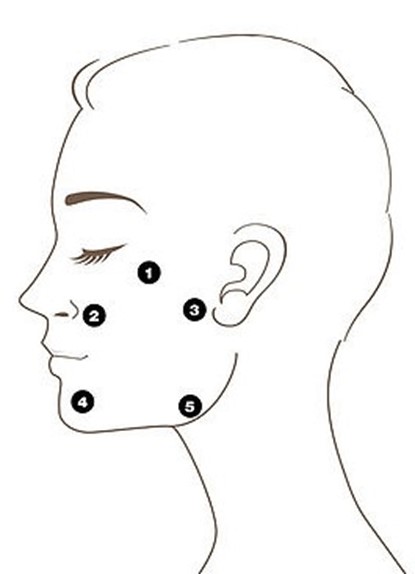 از ژل پروفایلو در چه مناطقی میتوان استفاده کرد؟