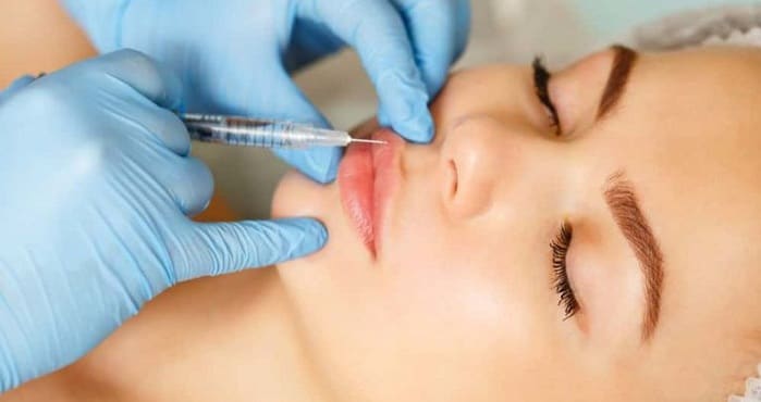 تزریق ژل ژوویدرم در لب و دهان