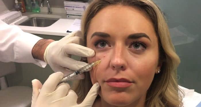 تزریق ژل ژوویدرم زیر چشم