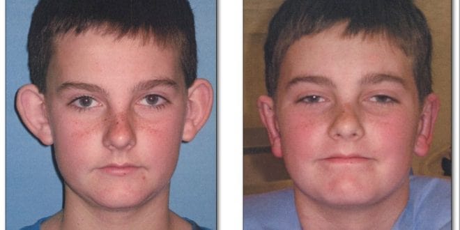 در طول جراحی چه اتفاقاتی میافتد