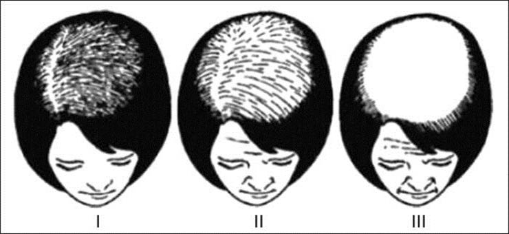 منتشر (پیشرونده)