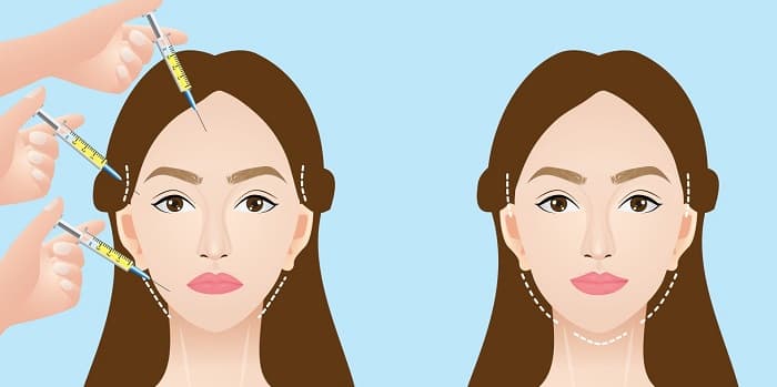 نحوه مدلینگ صورت با تزریق چربی