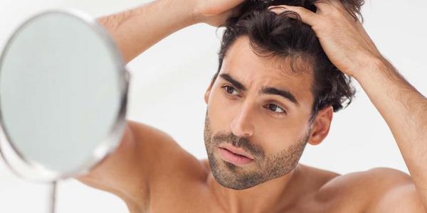 روش‌های پیشگیری از ریزش موی مردان-min