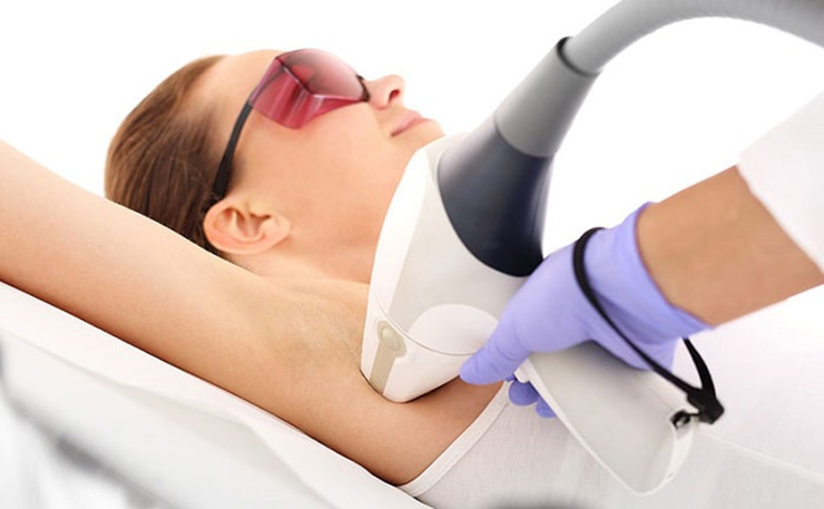 مراقبت های لیزر موهای زائد